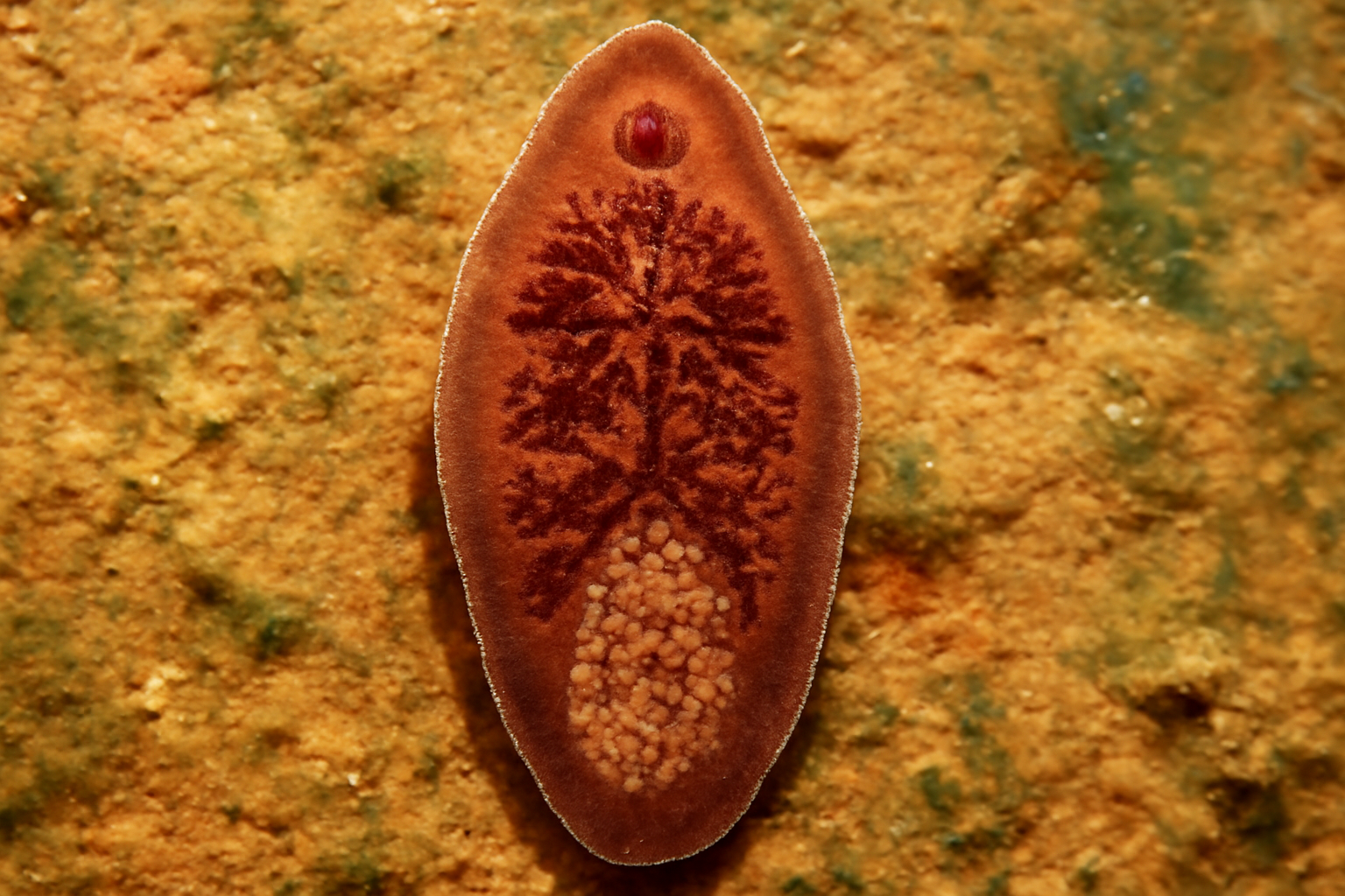 Giant intestinal fluke